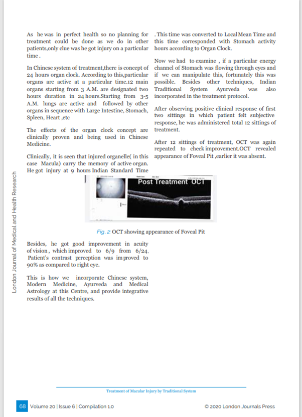 Treatment of Macular Injury by Traditional System post treatment OCT research article Dr Ved Prakash Banga 