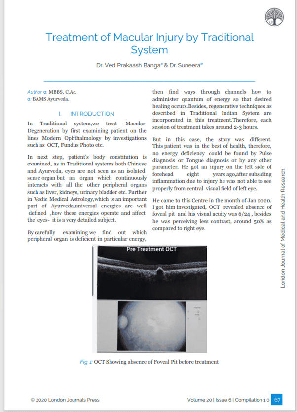 Treatment of Macular Injury by Traditional System post treatment OCT research article Dr Ved Prakash Banga  