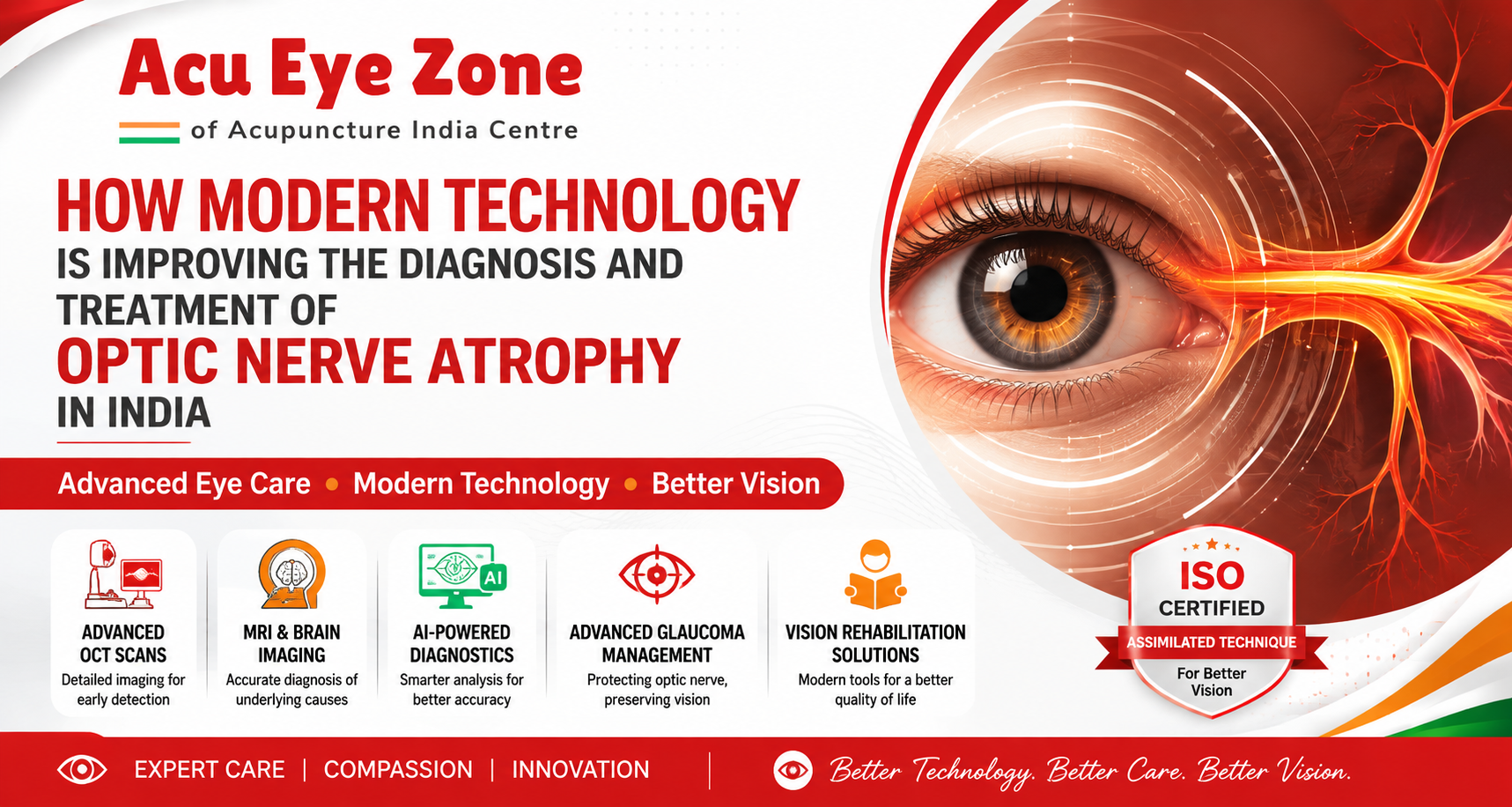 How Technique developed at Acu Eye Zone Is Improving Optic Nerve Atrophy Treatment