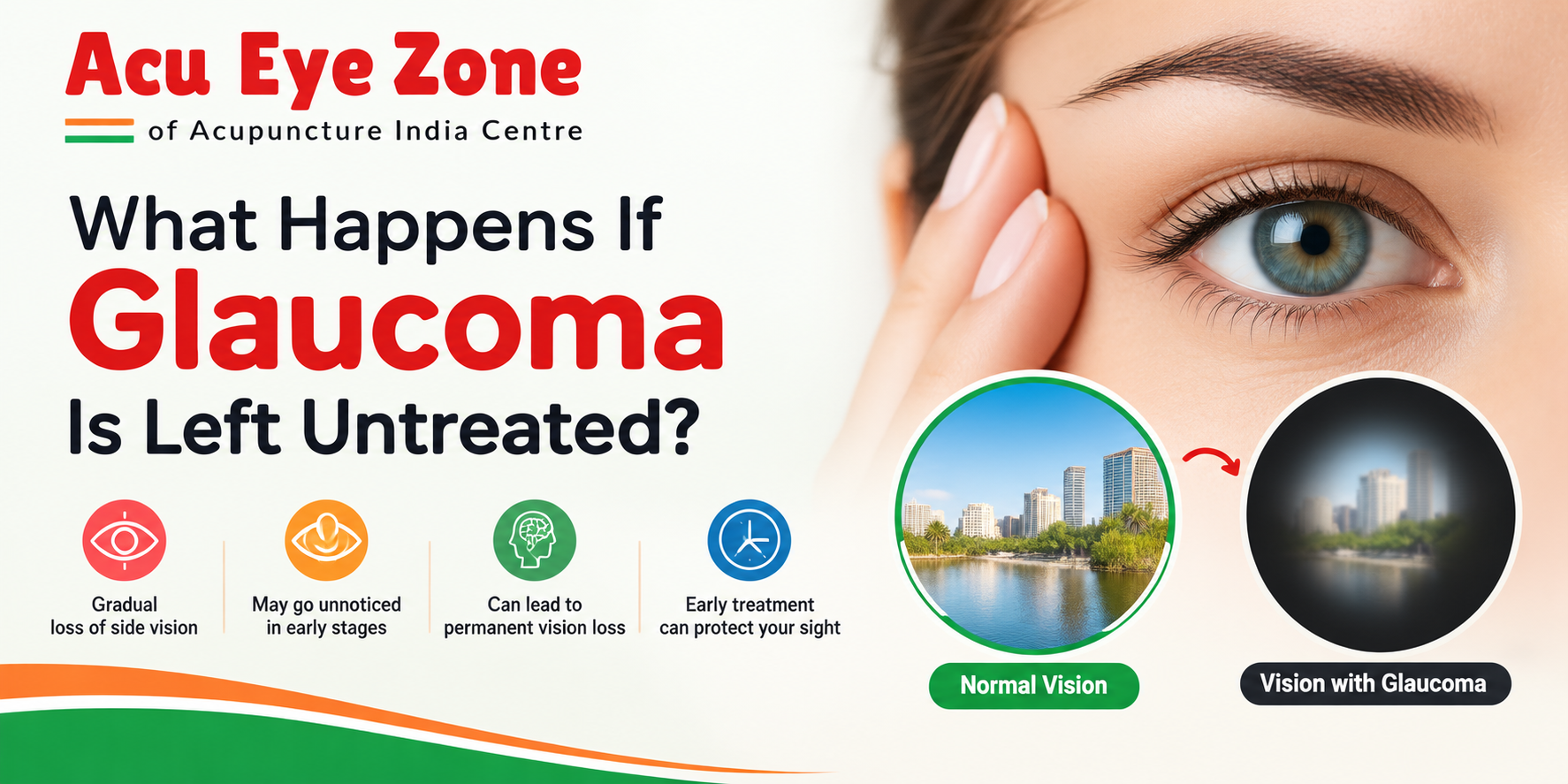 What Happens If Glaucoma Is Left Untreated